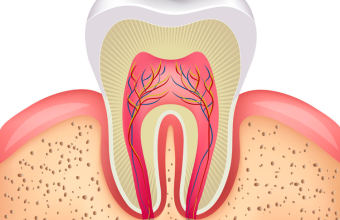 Надкостница зуба: строение, воспаление, лечение