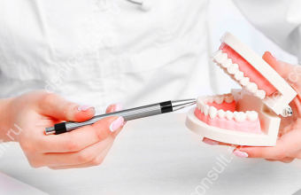Недорогая имплантация всех зубов: опасности и как их избежать