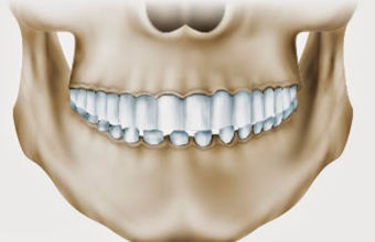 5 фактов о глубоком прикусе, которые заставят не откладывать визит к ортодонту