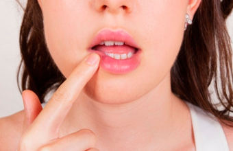 9 особенностей такой патологии, как киста на губе