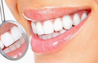 4 самых безопасных и эффективных метода отбеливания зубов