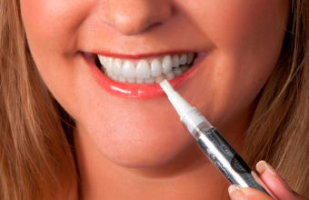 Карандаш для отбеливания зубов Luxury White Pro: обзор средства