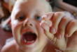 8 актуальных рекомендаций после удаления зуба у ребенка