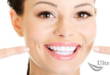4 метода безопасного отбеливания зубов в домашних условиях