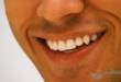 Художественное наращивание зубов: плюсы и минусы технологии