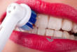 ТОП-5 лучших электрических зубных щеток