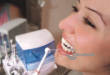 ТОП-5 лучших ирригаторов для чистки зубов