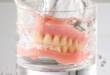 7 правил ухода за съемным зубным протезом