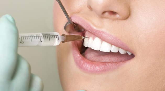 Может ли тошнить от наркоза при лечении зубов thumbnail