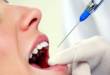 6 видов местной анестезии в стоматологии: что выбрать