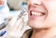 7 проблем, которые решит профессиональная чистка зубов