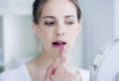 5 причин появления заед в уголках рта и способы их лечения