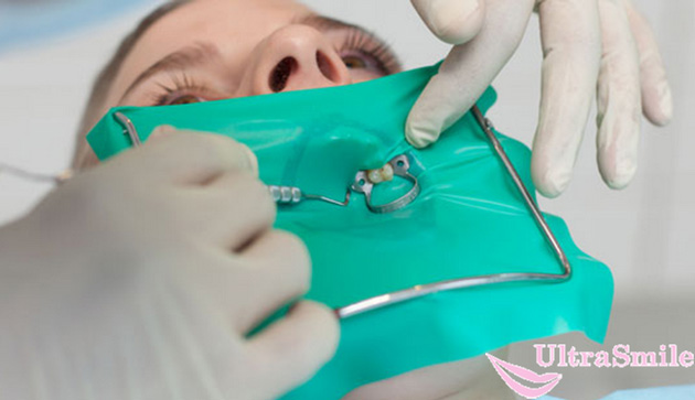 Как подавить рвотный рефлекс при лечении зубов thumbnail