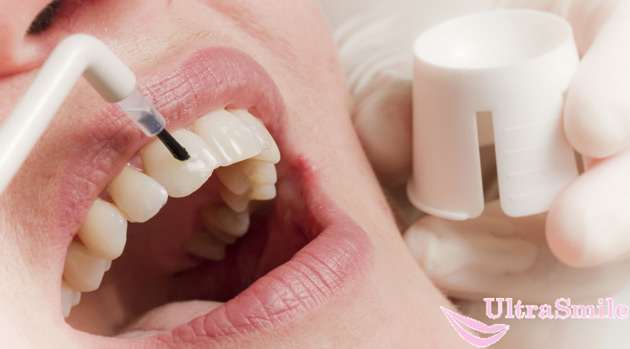 Лечение шейки зуба фото thumbnail