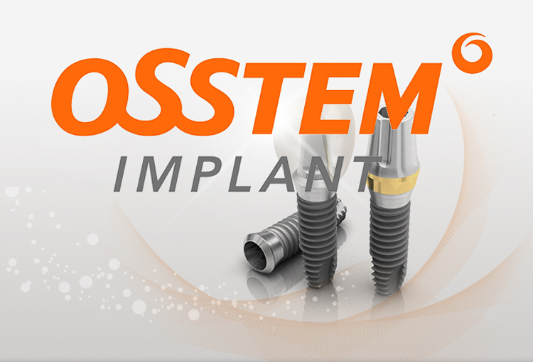 Особенности, недостатки и преимущества имплантов Osstem