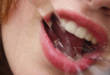 8 причин, которые могут объяснить, почему во рту много слюны