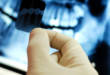 Рентген в стоматологии: 7 типов снимков полости рта