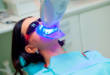 7 особенностей технологии холодного отбеливания зубов