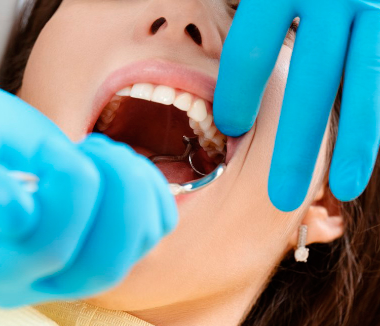 3 причины, почему опухла щека после удаления зуба, и что делать