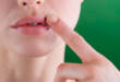 6 типов болячек на губе с фото: что это такое и почему возникает