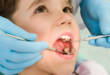 Всё, что нужно знать про кариес молочных зубов у детей