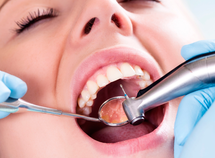 6 советов, которые пригодятся при лечении передних зубов