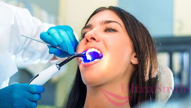 7 оптимальных методов восстановления жевательных зубов