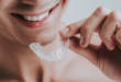 7 разновидностей кап в стоматологии: капы после брекетов и не только