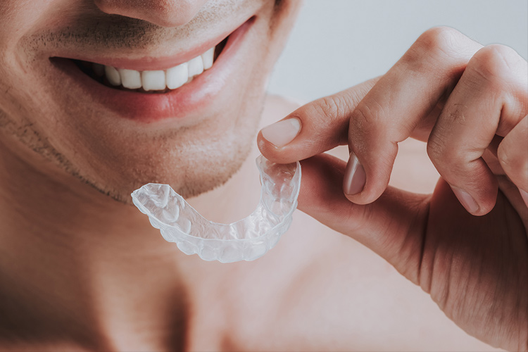 7 разновидностей кап в стоматологии: капы после брекетов и не только
