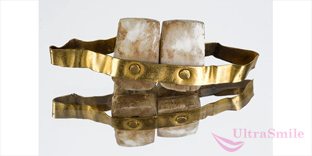 Древнем Египте местные лекари использовали золото для изготовления небольшим проволок