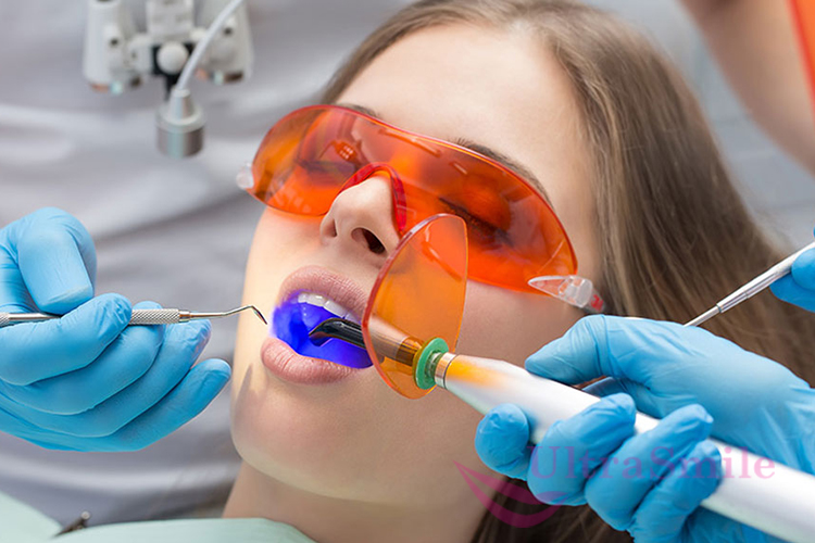 5 причин, почему болит зуб при надавливании после пломбирования