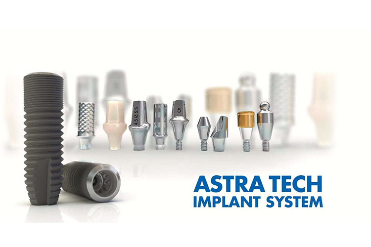 5 особенностей имплантационной системы Astra Tech обзор бренда
