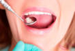 Сколько держится временная пломба в зубе