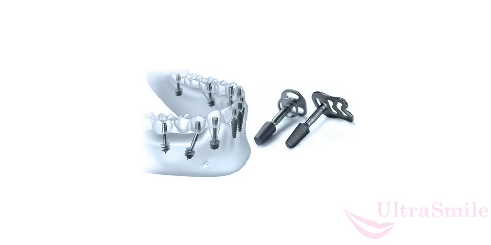 Базальная имплантация – это одноэтапный метод восстановления зубов, для него используют специальные импланты, на которые через несколько дней поставят полноценные протезы.